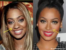 The hairstylist does a perfect job and made her look like an angel. Lala Anthony Plastic Surgery Comparison Photos