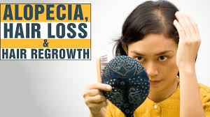 Thanks to its high amount of vitamin c, it helps to limit the state of hair loss. 7 Best Home Remedies For Alopecia Areata Rapid Hair Loss Baldness Youtube