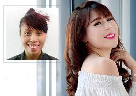 Ngắm dung nhan xinh đẹp của những ca phẫu thuật hàm hô chất lượng