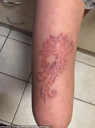 Sun tattoos sun tattoos and body art seattle display tattoo me sun. Sydney Girl Suffers Horror Infection After Getting A Henna Tattoo In Bali Daily Mail Online