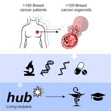 They didn't know where she'd been, and don't know how old she is. A Living Biobank Of Breast Cancer Organoids Captures Disease Heterogeneity Sciencedirect