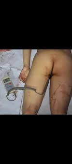 閲覧注意】19歳少女の死体画像、なぜか男達を興奮させてしまう（画像あり） - ポッカキットポッカキット