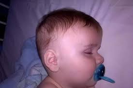 Baby with meningitis sent home from hospital after doctors dismiss illness  as chest infection