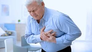 Infarto agudo do miocárdio é necrose miocárdica resultante de obstrução aguda de uma artéria coronária. Sintomas Do Infarto Agudo Do Miocardio Md Saude