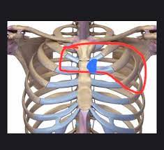 Webmd takes a look at the causes, symptoms, diagnosis, and treatment of this condition. Pain In This Area Body Movements And This With Blue The Best Pain Point Costochondritis