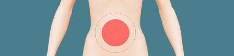 Hernias De Parede Abdominal Grupo Surgical