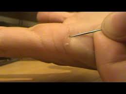 Splinters occur when a small, thin fragment of wood or other material punctures the skin and becomes embedded. How To Remove Splinters Szalka Youtube