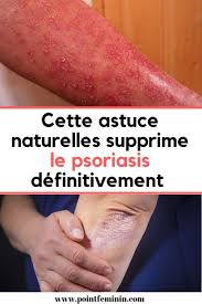 Pin On Sante