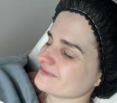 Best Aesthetic Treatment Clinic in Liverpool