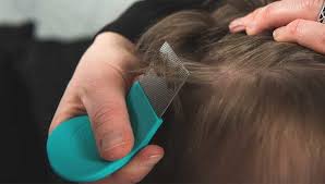 Spinosad is approved for use with people age 6 months or older. Home Remedies For Head Lice What Works