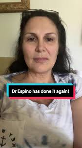 Dr Espino has done it again! Yes- we have availability with him Yes-  consults are free All the information get started is linked in our profile  #fyp #drespino #deepplanefaceilft #mexicofacelift ...