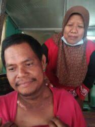 | mhi (15 ogos 2019). Isteri Tabah Jaga Suami Hidap Kanser Hidung Utusan Digital