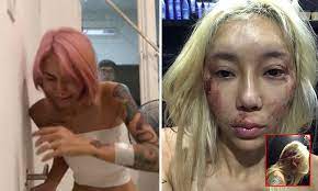 Two people injured after shooting in frederick, maryland, gunman killed. Malaysian Dj Leng Yein Posts Photos Of Bloodied Self On Fb Accuses Ex Boyfriend Of Abuse Over Past 2 Years Malaysia News Asiaone