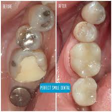 Ask a question about working or interviewing at perfect smile dental care. Perfect Smile Dental In Tijuana Mexico Read 39 Reviews