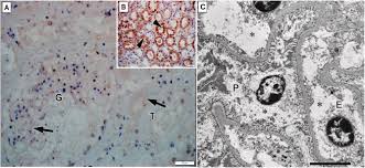 Image result for Indigofera cryptantha