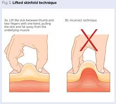 administering drugs via a subcutaneous injection nursing times