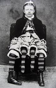 Josephine myrtle corbin was given birth to on the 12th of may, 1886, in lincoln county, tennessee as a dipygus. 20 Tremendous Human Curiosities Of P T Barnum S Shows