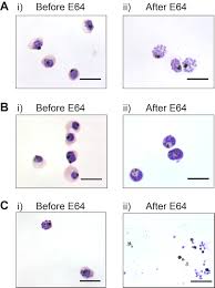The spatial distribution of plasmodium falciparum malaria endemicity in 2010. High Yield Purification Of Plasmodium Falciparum Merozoites For Use In Opsonizing Antibody Assays Protocol