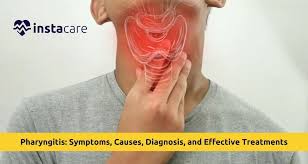 Image result for Pharyngitis