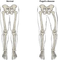 Want to learn more about it? 6 3 Bone Structure Anatomy Physiology