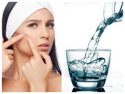It also helps prevent split ends and brittle hair, as well as makes your scalp healthy. Drink Water To Get Rid Of Those Pimples The Times Of India