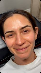 ✨ Natural Ombré Brows ✨ , A soft, shaded permanent makeup technique that  creates a defined yet natural look—darker at the tail and lighter at the  front for a seamless gradient., Ideal for:, ✨Normal, ...