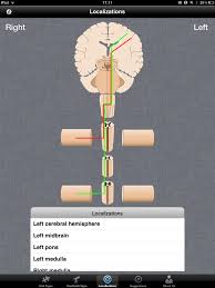Image result for Neurologic Lesion Localization
