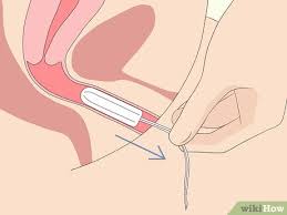 Check spelling or type a new query. 10 Manieres De Mettre Un Tampon Wikihow