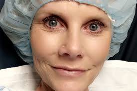 Fundraiser for Stacey Frank by Kourtney Swift : Another makeover for  Stacey's heart