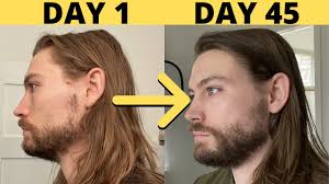 Patchy and unkempt facial hair that looks like you just forgot to shave. How To Grow More Facial Hair Without Minoxidil Youtube