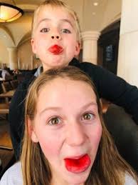 Teddy Bruce Memorial Fund