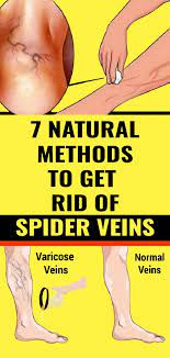 Are Saggy Stomach Skin Smooth And Soft Home Remedies Vein Health Health Tips Health Fitness