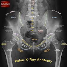 Want To Learn A System For Reviewing A Pelvic X Ray Read On To Find Out And Swipe Left To Touch Up On Your Radiology Radiology Student Medical Anatomy