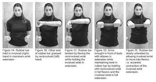 The pain may also extend into the back of the forearm and grip strength may be weak. Tennis Elbow Lateral And Medial Epicondylitis The Nicholas Institute Of Sports Medicine And Athletic Trauma