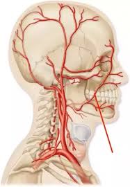 The arteries of the head and neck. Which Artery Is The Easiest To Sever Quora