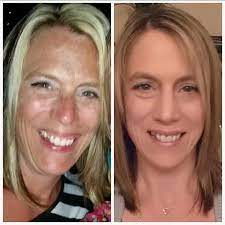 Can i reverse the damage caused by uv exposure? Where Can I Buy An At Home Tanning Bed Quora