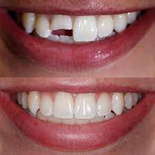 Back To Normal Athletic Trainer Cosmetic Dentistry Dentistry