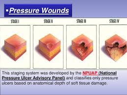 Wound Care