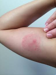 karbonatin 19 mucizesi bilgecafe karbonat dogal saglik hayata dair ipuclari