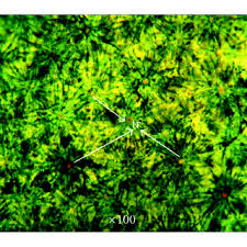 Image result for Phragmanthera capitata