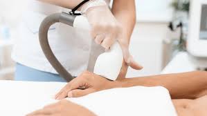 If you want to get laser hair removal. General Areas Of Laser Hair Removal Include But Are Not Limited To Laser Hair Removal Melisa Laser Clinic