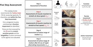 Image result for Rapid Alternating Movements