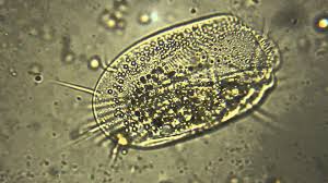 Filmy 4k i hd dostępne natychmiast na dowolne nle. Euplotes Pond Life Microscopic