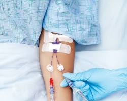 Image of IV drip or injection syringe