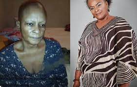 Gloria young said that ify tried sourcing for funds for her treatment but has met a brick wall. 0g3ss Ltps96hm