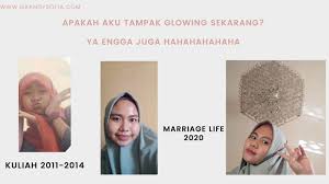 Bagaimana caranya menghilangkan jerawat yang membandel. Cara Menghilangkan Jerawat Membandel My Acne Story Travel And Food