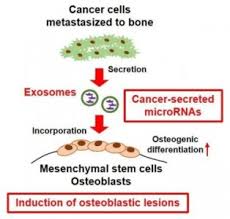 PNAS：肿瘤外泌体miR-940促进肿瘤微环境中的成骨表型- 外泌体资讯网