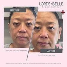 REGENPEN DAILY CARTRIDGE