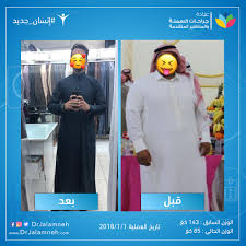 gallery obesity and advanced laparoscopic surgery clinics