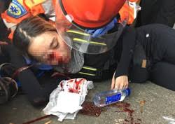 The site owner hides the web page description. çœŸç›¸å¤§ç™½ çˆ†çœ¼å¥³äº‹ä»¶å››å¤§è°œå›¢é€ä¸ªè§£å¼€ è§‚å¯Ÿè€…ç½'